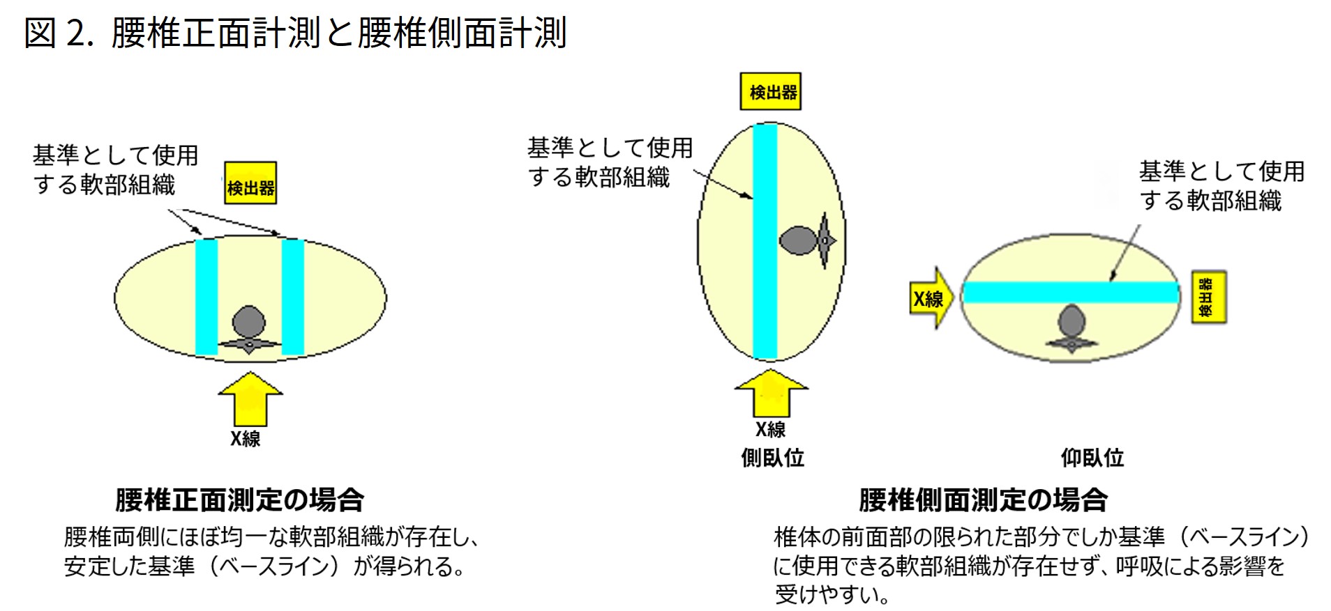 Technical Tips_lateral lumbar BMD03.jpg